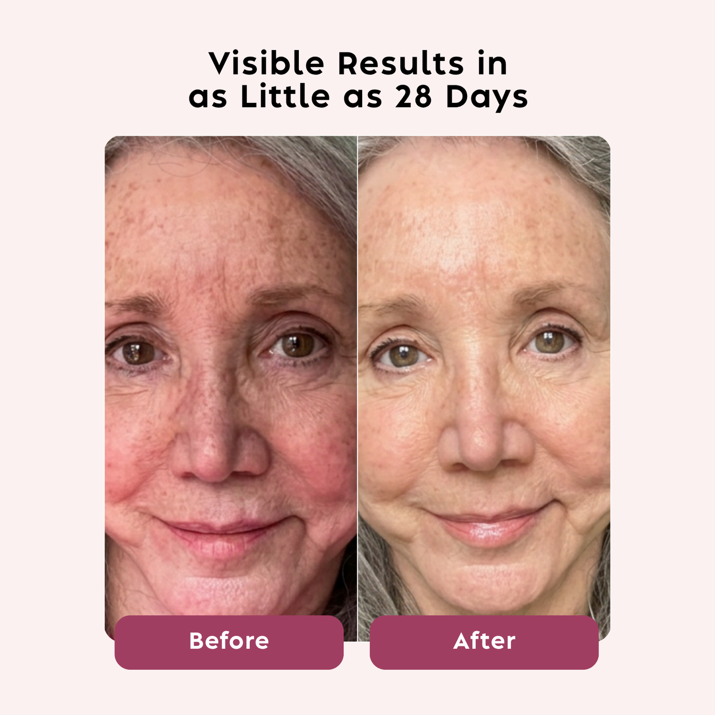Naraskin Lab Hyaluronic Acid Serum